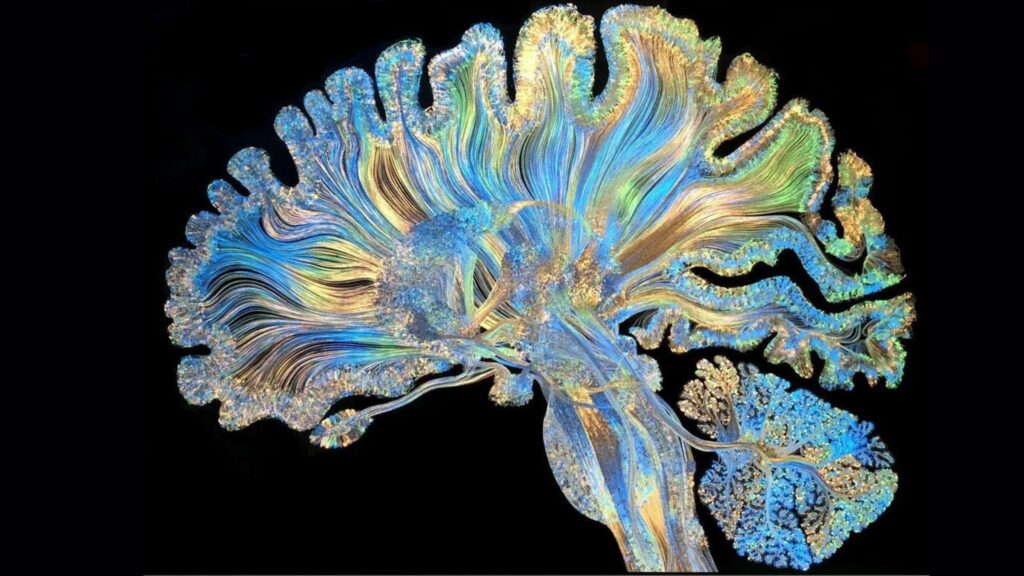 Imagen a color de un cerebro arte aimi medicina integrativa avanzada